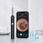 OTOSKOP KAMERA DO CZYSZCZENIA USZU USUWANIA WOSKOWINY SMART HD ENDOSKOP